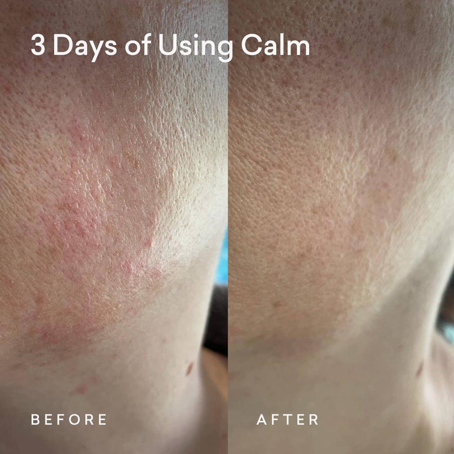 Floragy - Calm Face Oil: 30ml